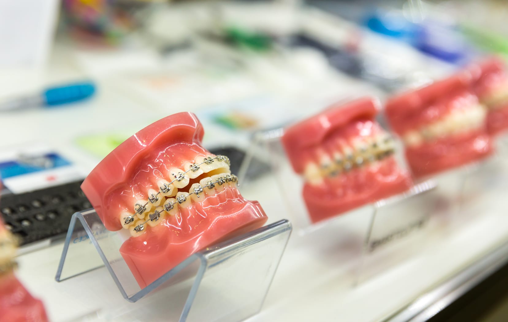 Tratamiento de ortodoncia para adultos para mejorar alineación dental y mordida