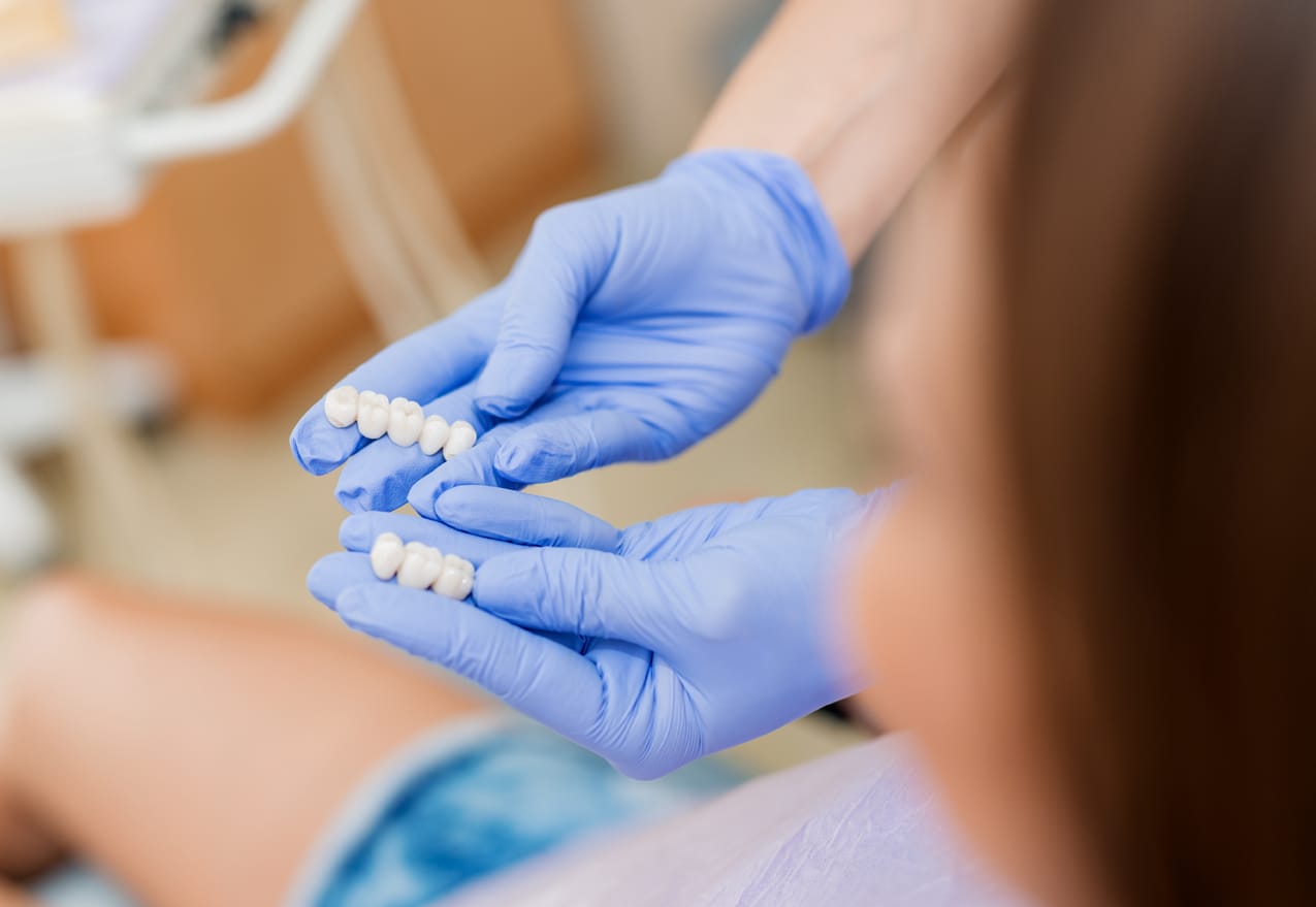 Carillas de porcelana para mejorar el aspecto y la armonía de la sonrisa