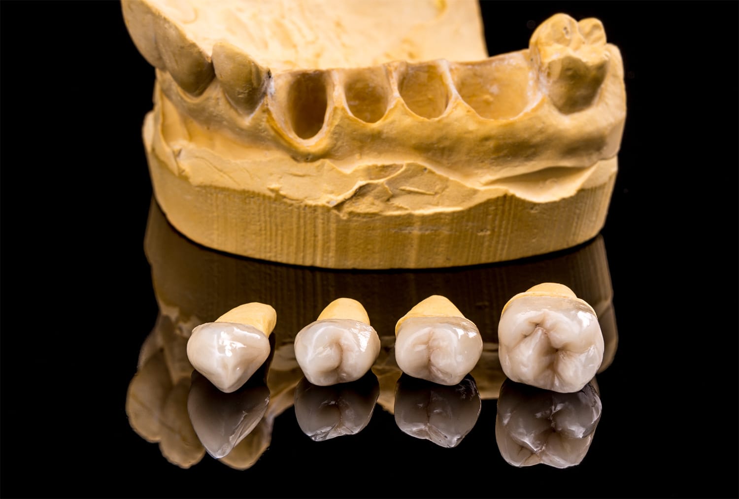 Extracción dental planificada tras valorar el estado del diente y sus raíces