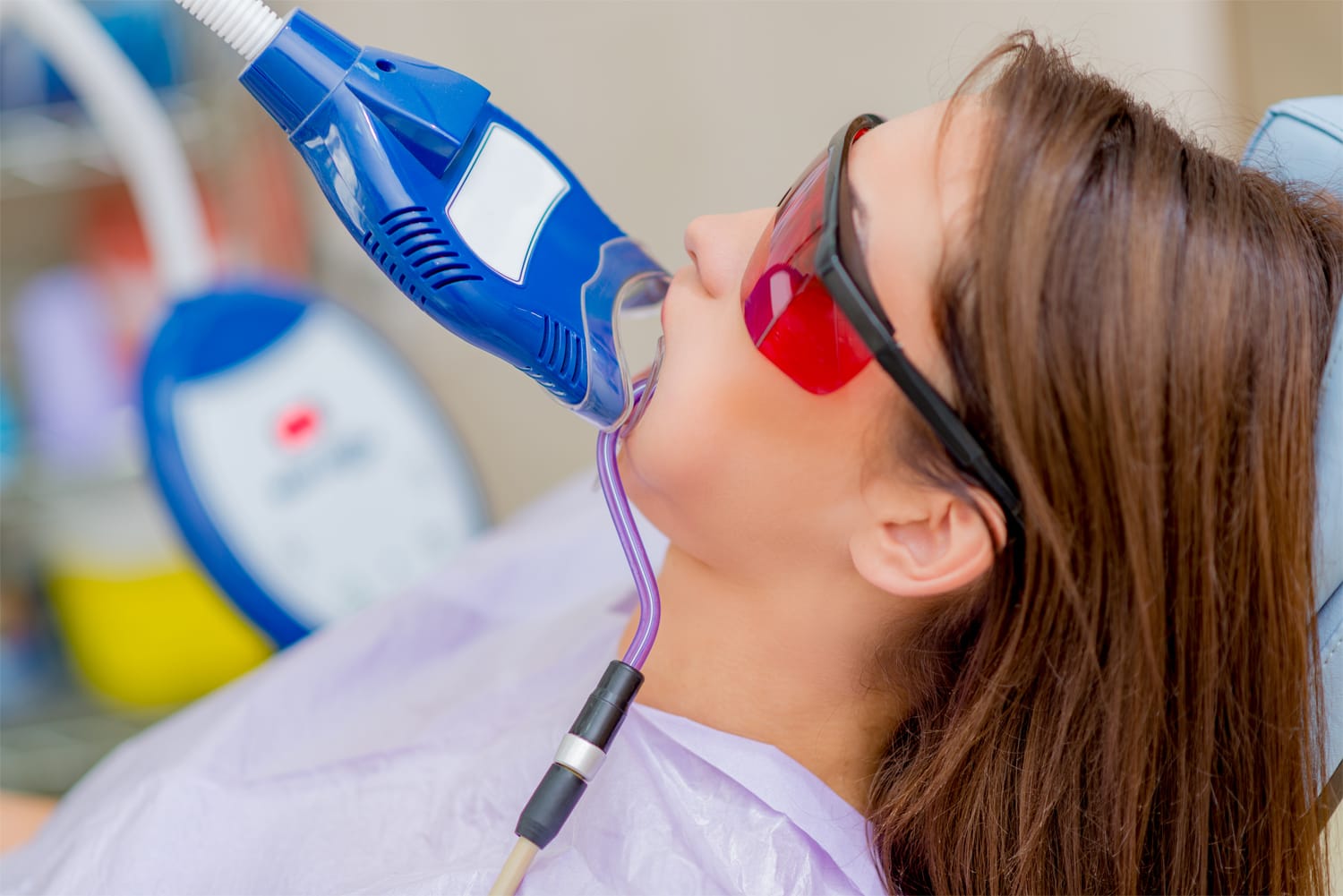 Blanqueamiento dental profesional con activación mediante luz en clínica