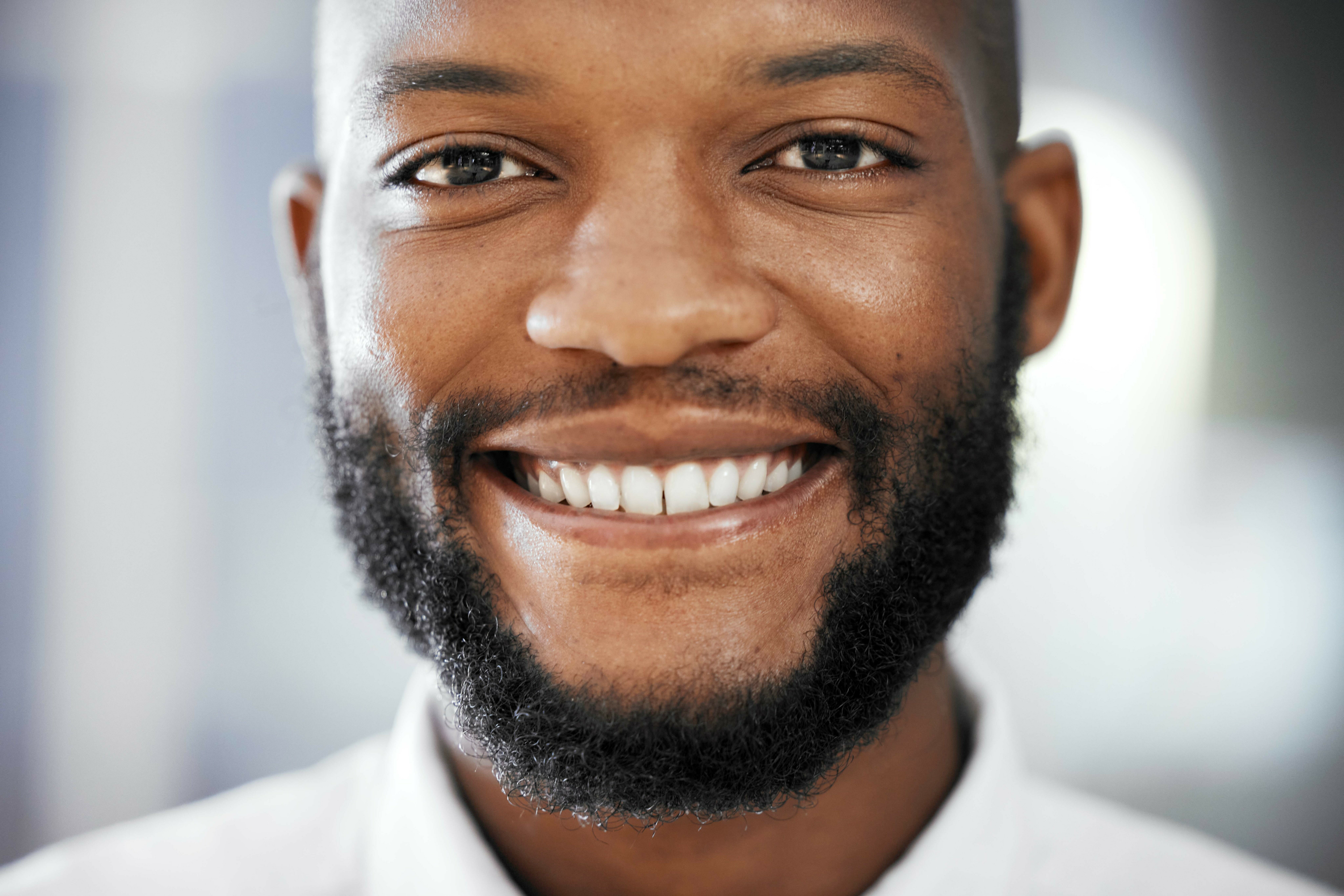 Resultado de blanqueamiento dental Hombre sonriendo y mostrando unos dientes blancos tras un tratamiento estético dental