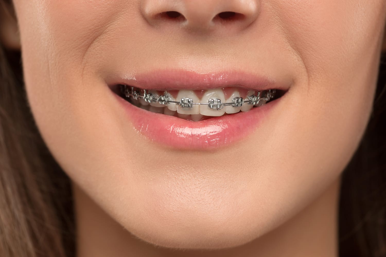Higiene dental durante la ortodoncia para limpiar correctamente dientes y aparatos