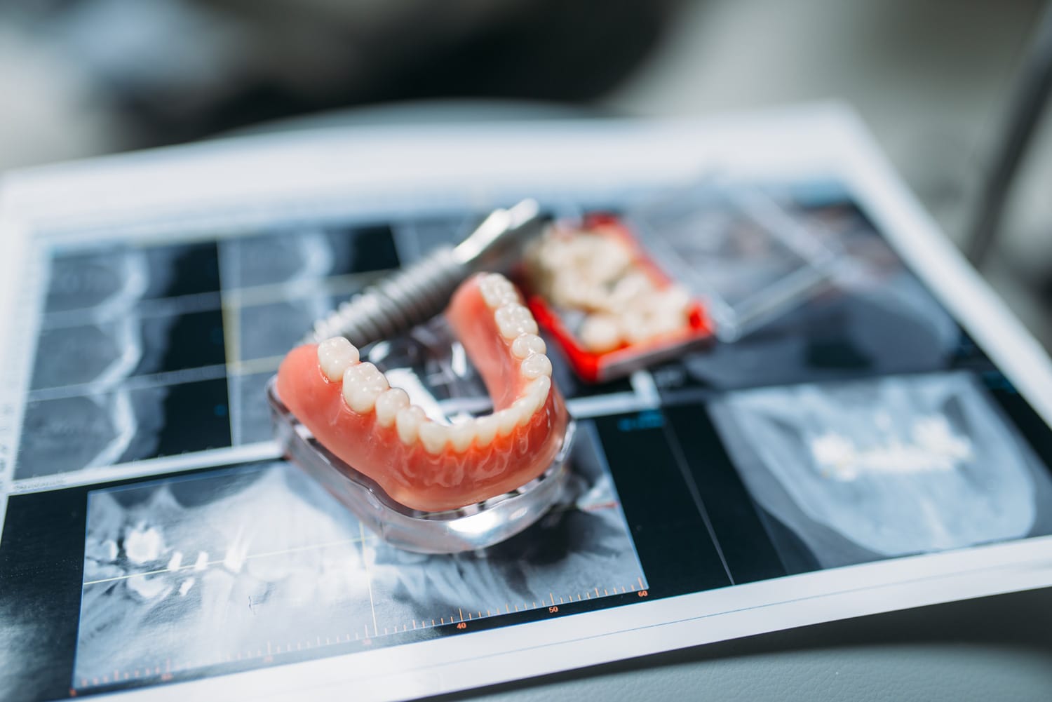 Tratamiento de cirugía oral y dental realizado tras una valoración especializada