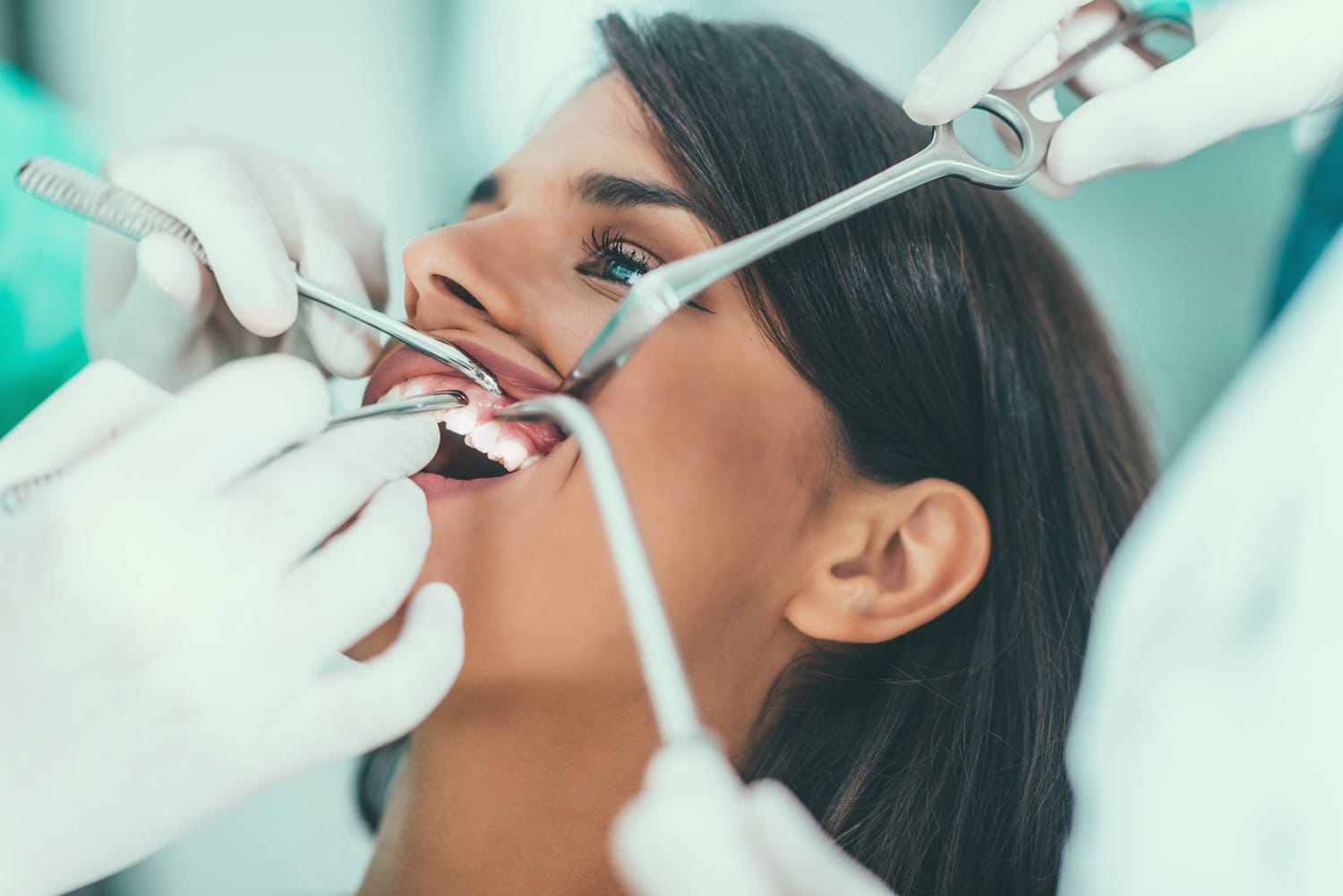 Tratamiento de encías para prevenir y controlar problemas periodontales