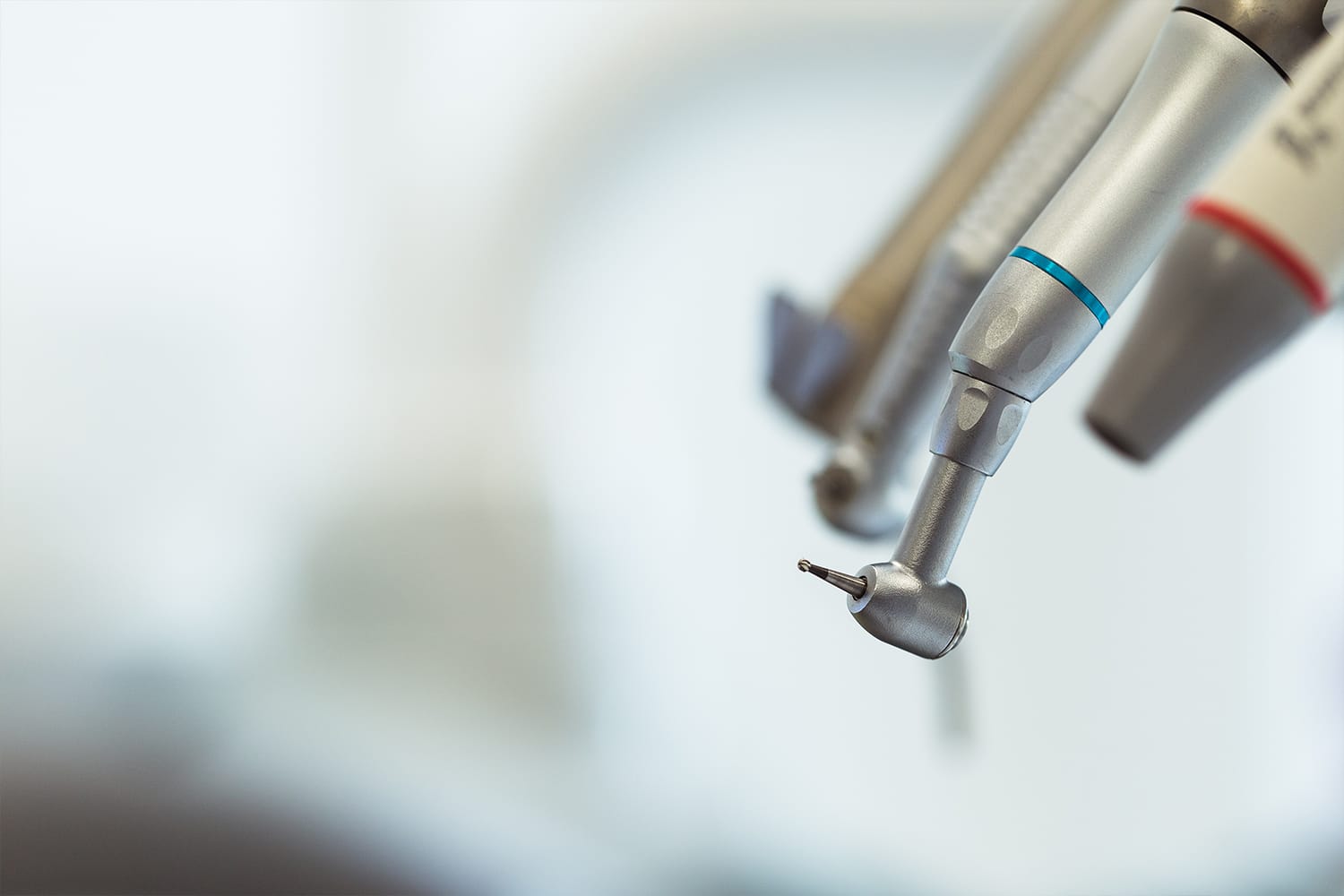 Pulpectomía para eliminar tejido pulpar afectado y conservar el diente
