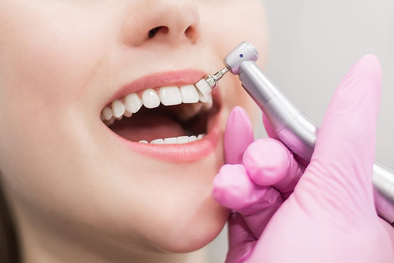 Tratamiento odontológico personalizado en Clínica García Rielo de Lugo