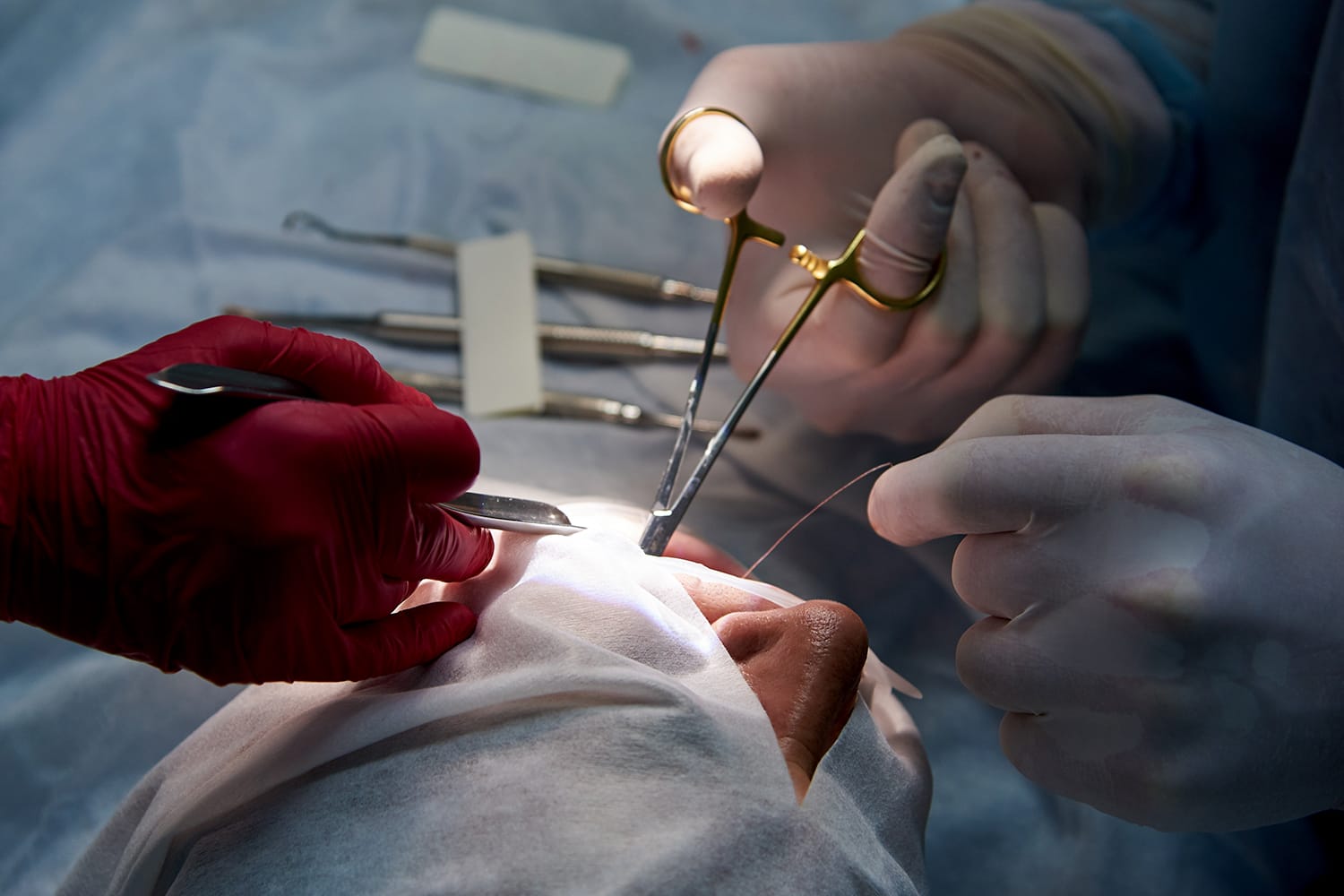 Implantología dental García Rielo Tratamiento de implantología dental en Clínica García Rielo