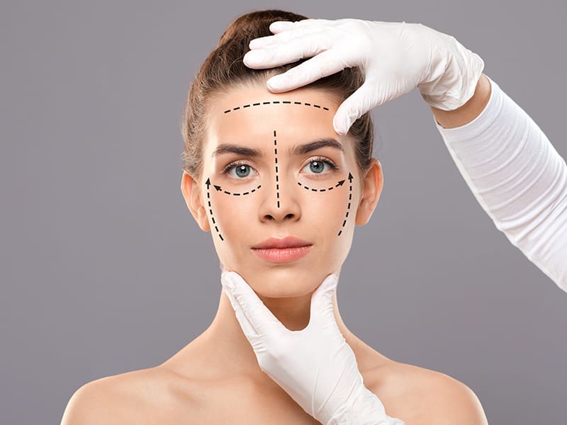 Blefaroplastia para rejuvenecimiento de los párpados