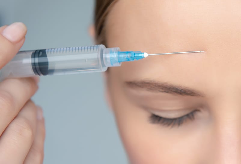 Tratamiento con bótox para suavizar arrugas horizontales de la frente