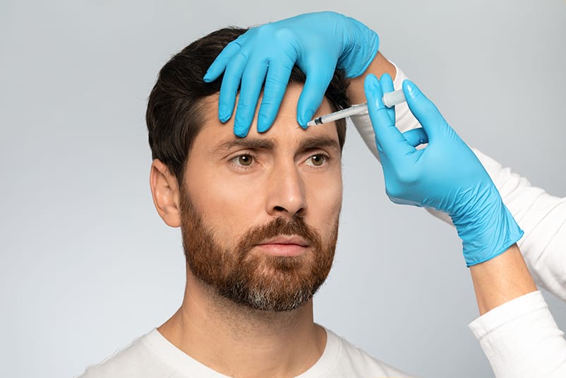 Tratamiento con bótox para líneas de expresión entre las cejas
