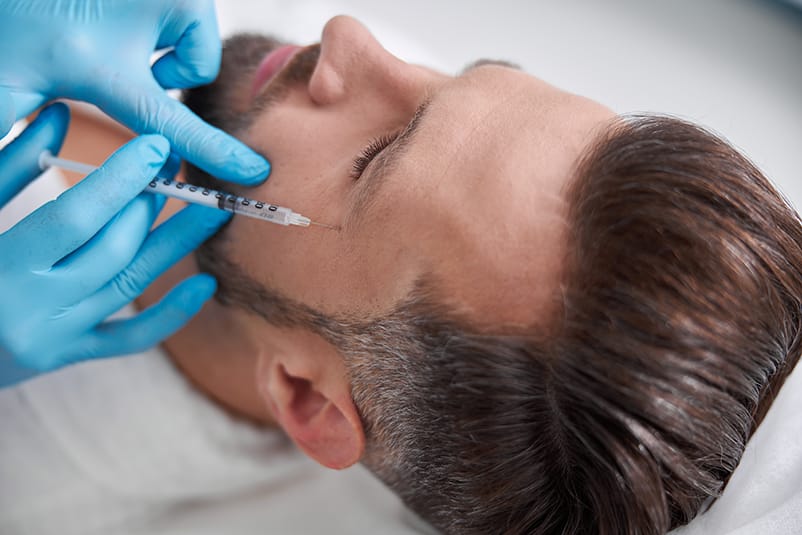 Tratamiento con bótox para suavizar las patas de gallo alrededor de los ojos