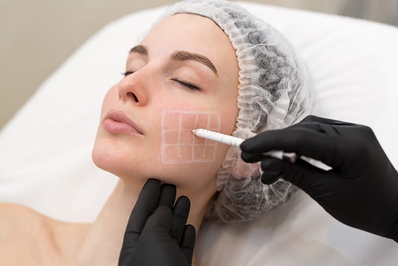 Planificación personalizada de una rinoplastia funcional y estética