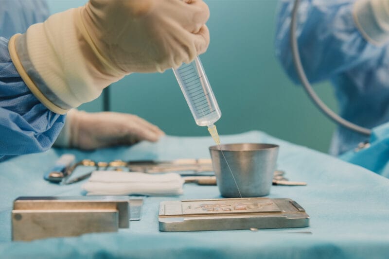 Procedimiento de rinoplastia ultrasónica para remodelar la nariz