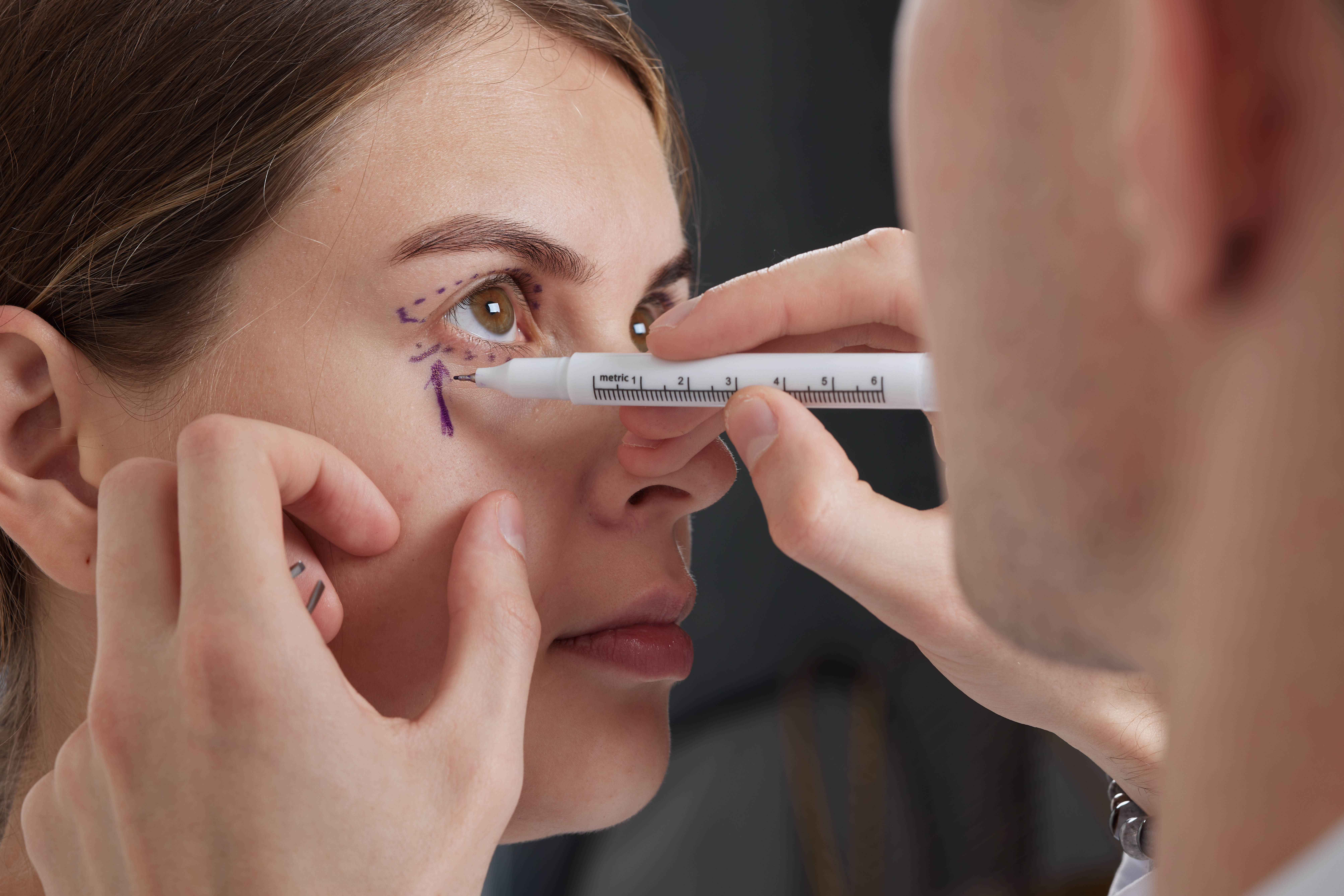 Preparación para una blefaroplastia Cirujano preparando la zona de los párpados antes de una blefaroplastia